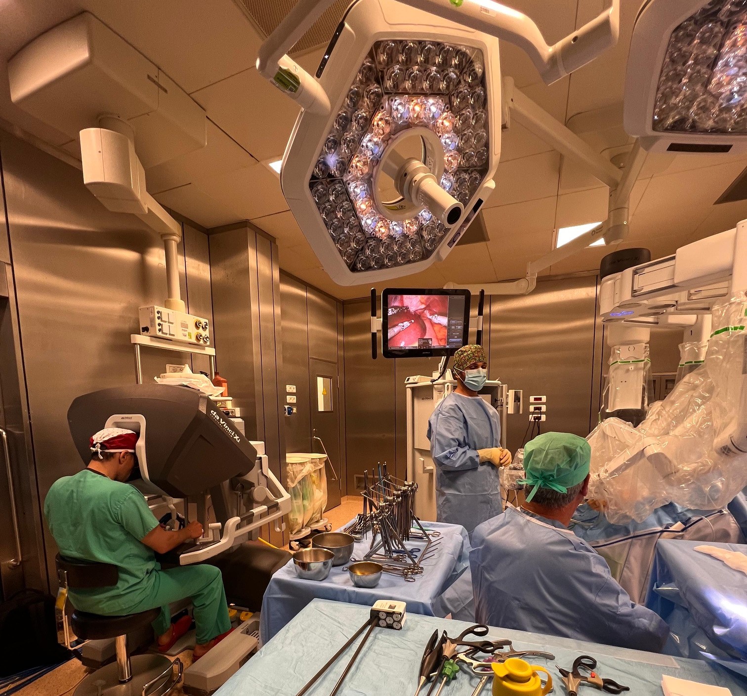 INTERVENTO MULTIDISCIPLINARE ROBOTICA Tumore all’esofago asportato con robot al Policlinico Catania