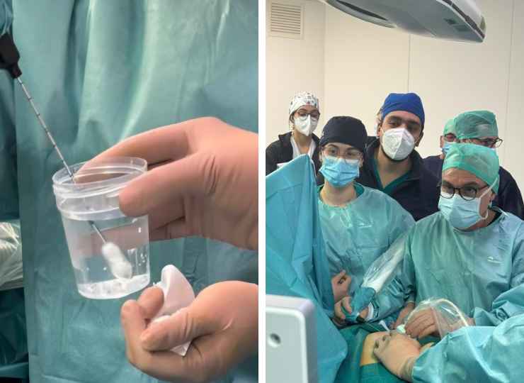 Breast Unit Catania crioablazione mininvasiva contro tumore al seno- FreePressOnline